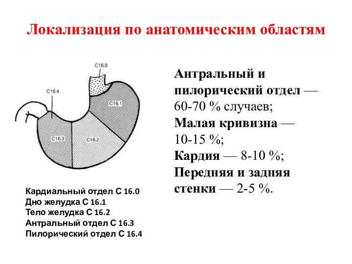 Локализация по анатомическим областям Антральный и пилорический отдел — 60-70