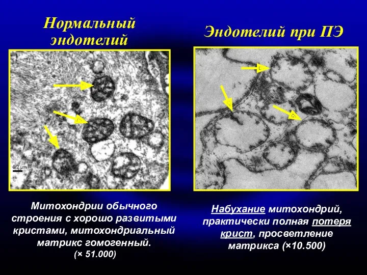 Митохондрии обычного строения с хорошо развитыми кристами, митохондриальный матрикс гомогенный.