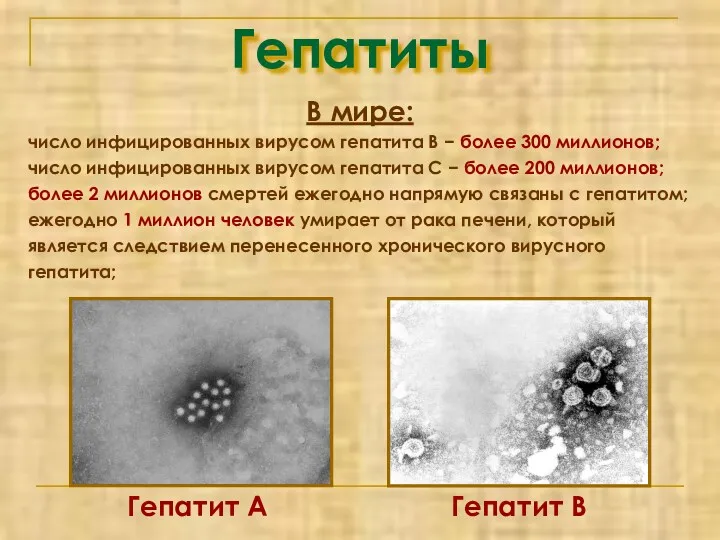 Гепатиты В мире: число инфицированных вирусом гепатита В − более 300 миллионов; число