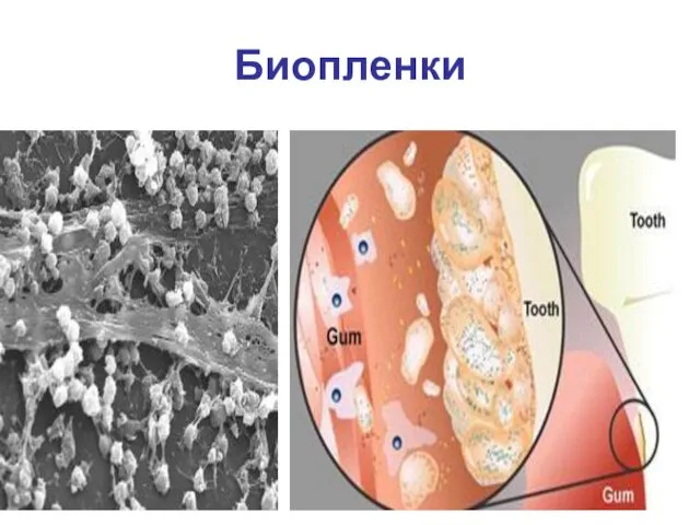 Биопленки