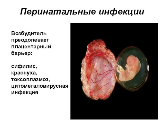 Перинатальные инфекции Возбудитель преодолевает плацентарный барьер: сифилис, краснуха, токсоплазмоз, цитомегаловирусная инфекция