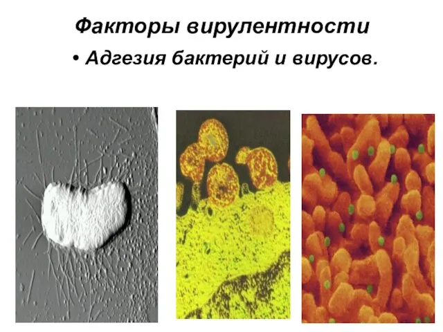 Факторы вирулентности Адгезия бактерий и вирусов.