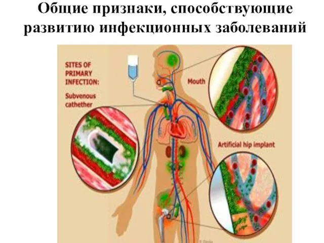 Общие признаки, способствующие развитию инфекционных заболеваний