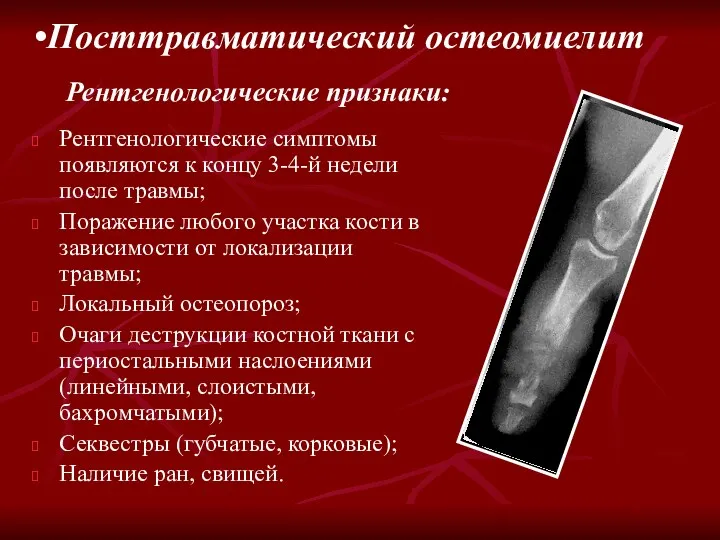 Рентгенологические симптомы появляются к концу 3-4-й недели после травмы; Поражение