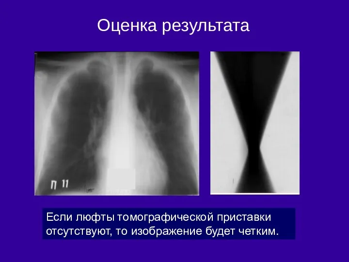 Оценка результата Если люфты томографической приставки отсутствуют, то изображение будет четким.