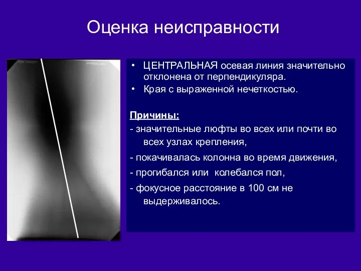 Оценка неисправности ЦЕНТРАЛЬНАЯ осевая линия значительно отклонена от перпендикуляра. Края