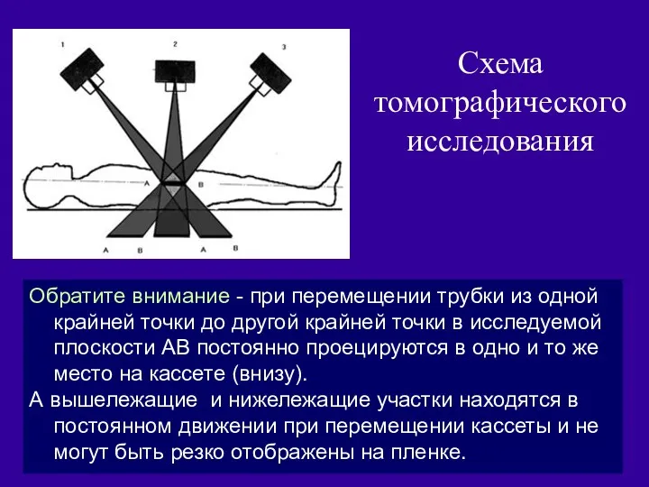 Схема томографического исследования Обратите внимание - при перемещении трубки из