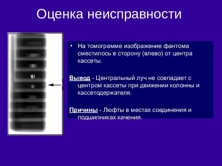 На томограмме изображение фантома сместилось в сторону (влево) от центра кассеты. Вывод -