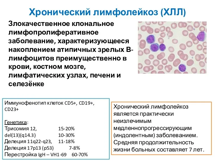 Хронический лимфолейкоз (ХЛЛ) Злокачественное клональное лимфопролиферативное заболевание, характеризующееся накоплением атипичных