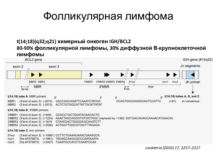 Фолликулярная лимфома t(14;18)(q32;q21) химерный онкоген IGH/BCL2 80-90% фолликулярной лимфомы, 30%