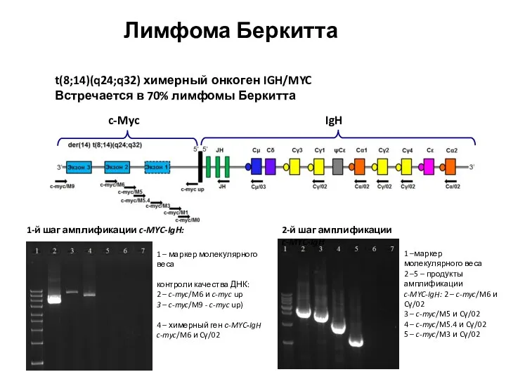 t(8;14)(q24;q32) химерный онкоген IGH/MYC Встречается в 70% лимфомы Беркитта c-Myc