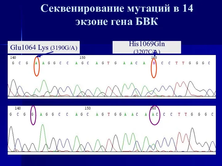 Секвенирование мутаций в 14 экзоне гена БВК Glu1064 Lys (3190G/A) His1069Gln (3207C/A)