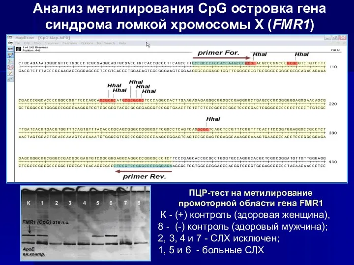 Анализ метилирования CpG островка гена синдрома ломкой хромосомы Х (FMR1)