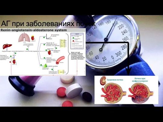 АГ при заболеваниях почек