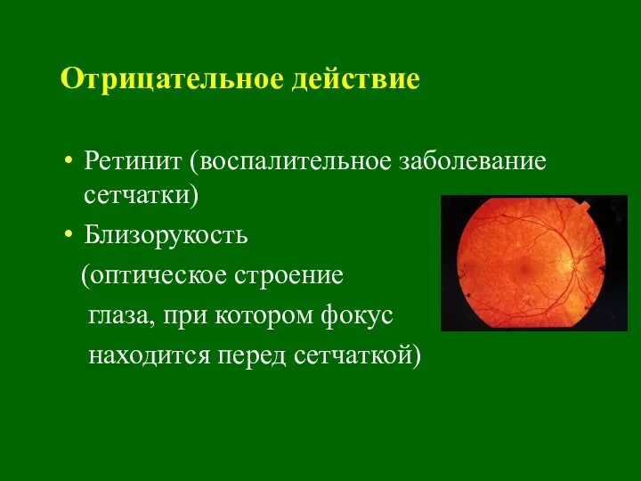Отрицательное действие Ретинит (воспалительное заболевание сетчатки) Близорукость (оптическое строение глаза, при котором фокус находится перед сетчаткой)