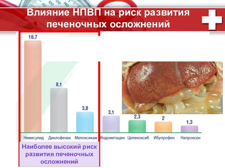 Влияние НПВП на риск развития печеночных осложнений Наиболее высокий риск развития печеночных осложнений