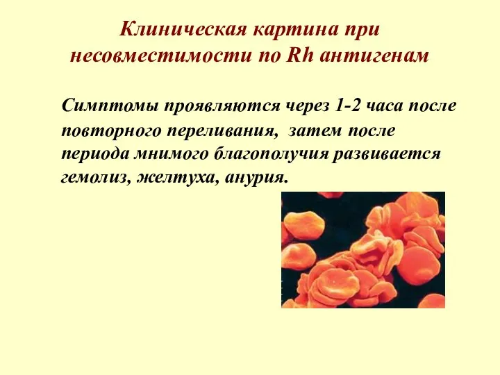 Клиническая картина при несовместимости по Rh антигенам Симптомы проявляются через