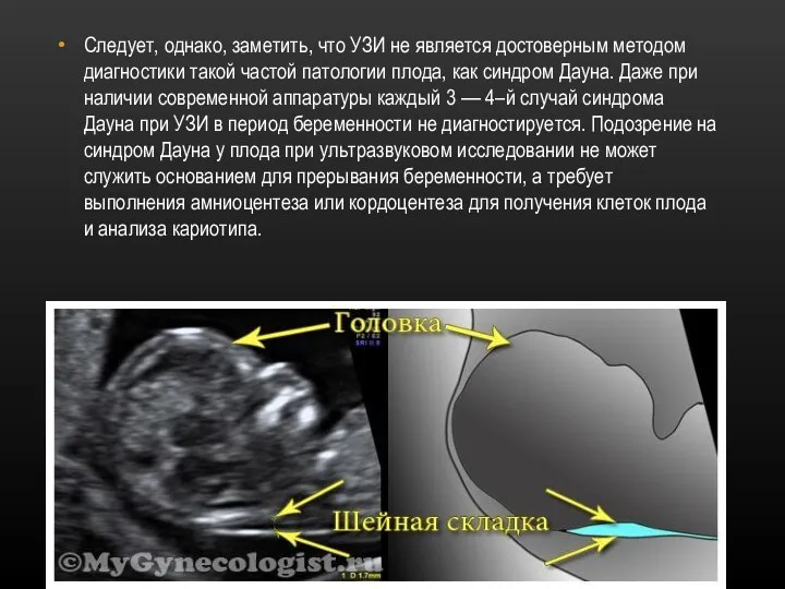 Следует, однако, заметить, что УЗИ не является достоверным методом диагностики