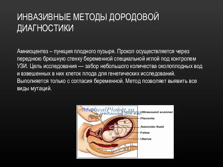 ИНВАЗИВНЫЕ МЕТОДЫ ДОРОДОВОЙ ДИАГНОСТИКИ Амниоцентез – пункция плодного пузыря. Прокол