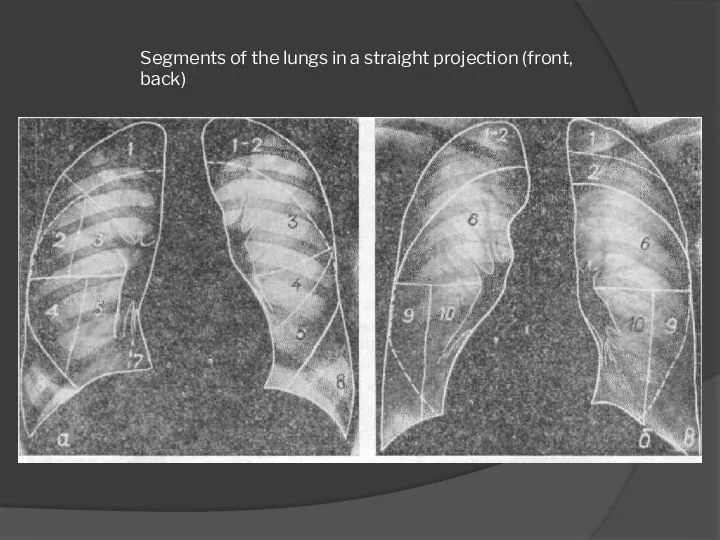 Segments of the lungs in a straight projection (front, back)