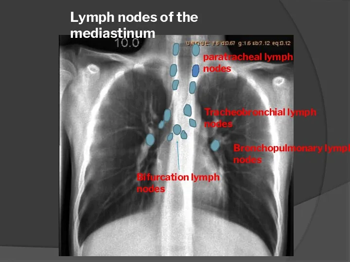 Lymph nodes of the mediastinum paratracheal lymph nodes Tracheobronchial lymph nodes Bifurcation lymph