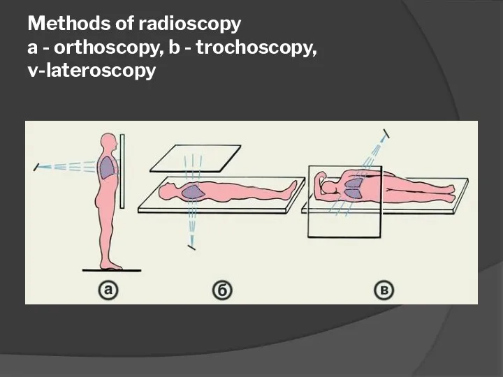 Methods of radioscopy a - orthoscopy, b - trochoscopy, v-lateroscopy