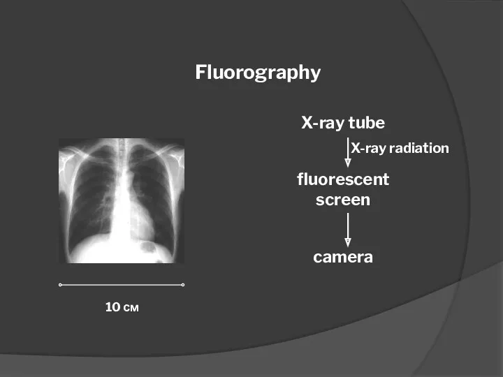 Fluorography X-ray tube fluorescent screen camera 10 см X-ray radiation