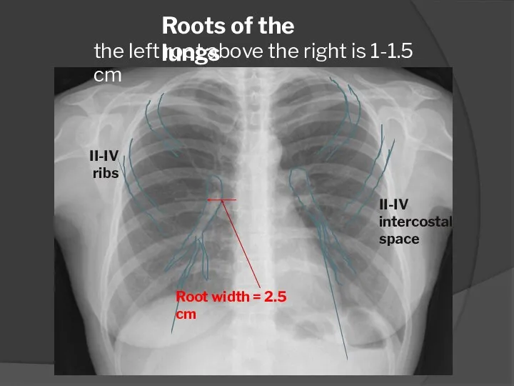 Roots of the lungs II-IV intercostal space II-IV ribs the left root above