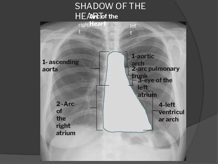 SHADOW OF THE HEART Arc of the Heart 1- ascending aorta 2 -Arc