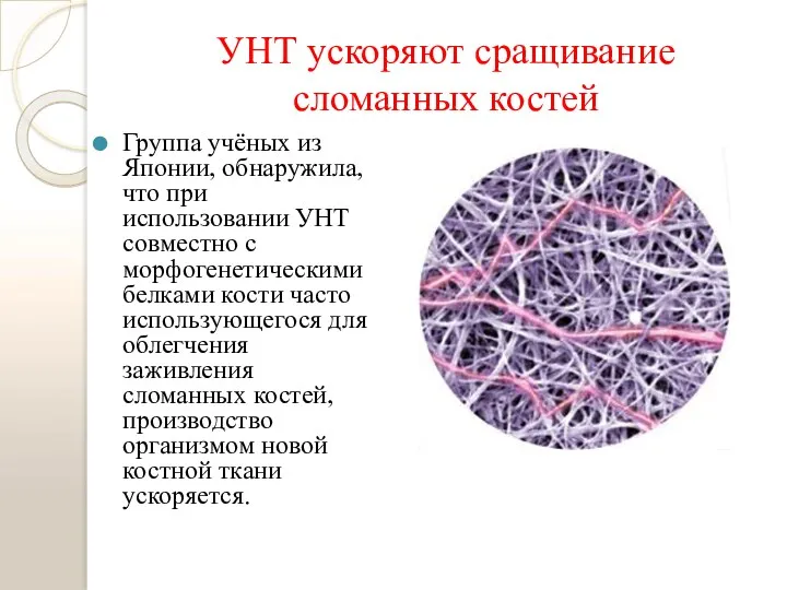 УНТ ускоряют сращивание сломанных костей Группа учёных из Японии, обнаружила,