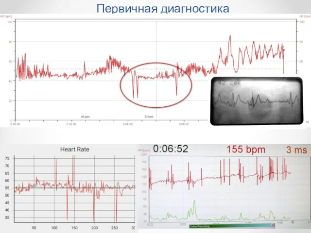 Первичная диагностика