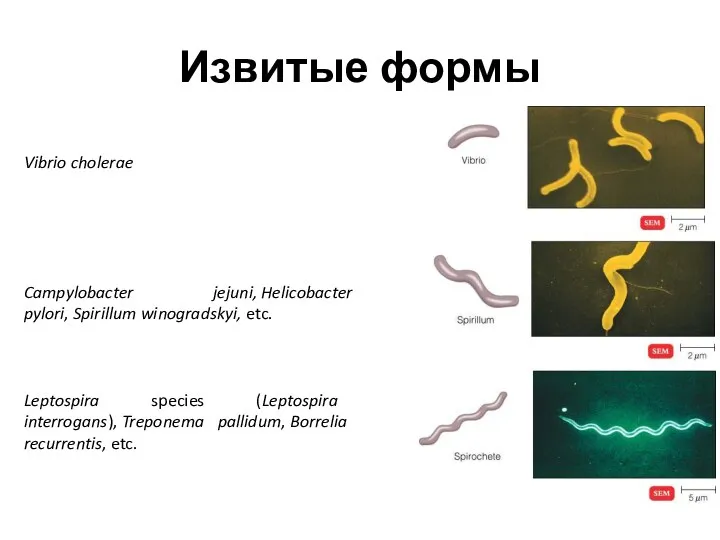 Извитые формы Vibrio cholerae Campylobacter jejuni, Helicobacter pylori, Spirillum winogradskyi, etc. Leptospira species