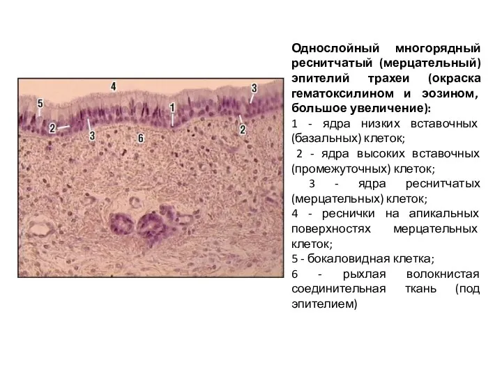 Однослойный многорядный реснитчатый (мерцательный) эпителий трахеи (окраска гематоксилином и эозином,