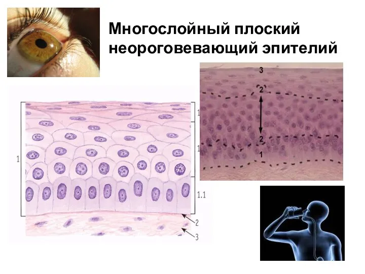 Многослойный плоский неороговевающий эпителий