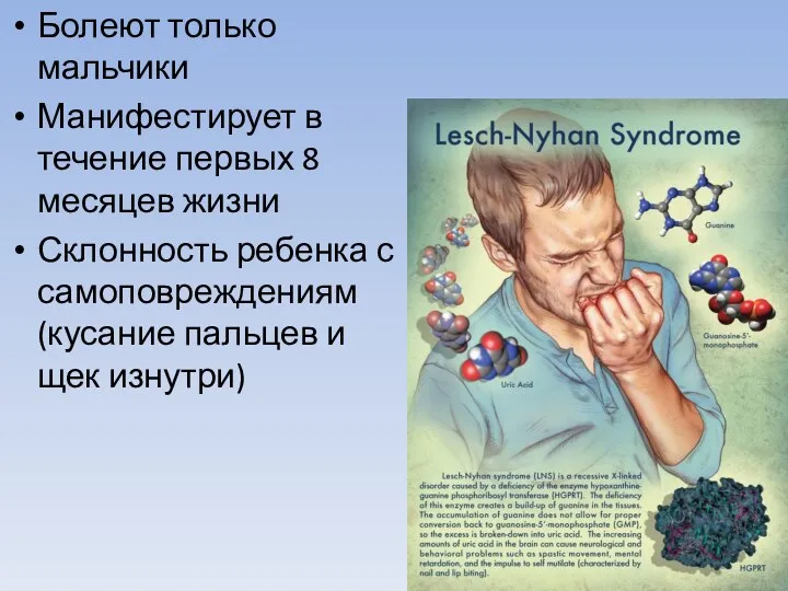 Болеют только мальчики Манифестирует в течение первых 8 месяцев жизни