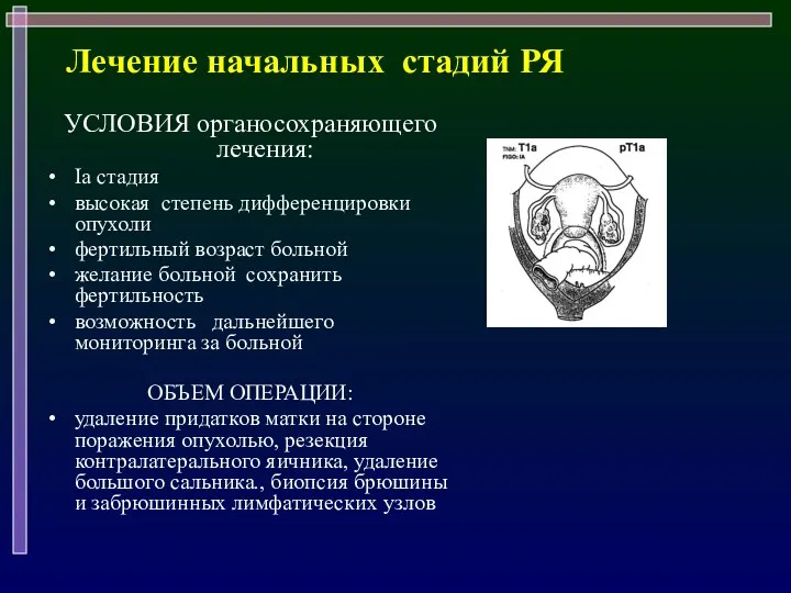 Лечение начальных стадий РЯ УСЛОВИЯ органосохраняющего лечения: Iа стадия высокая