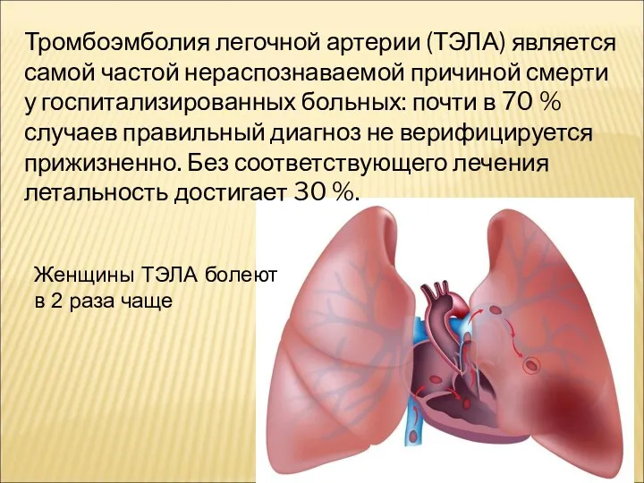 Тромбоэмболия легочной артерии (ТЭЛА) является самой частой нераспознаваемой причиной смерти
