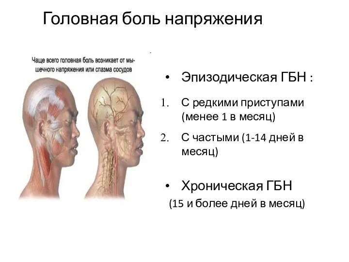 Головная боль напряжения Эпизодическая ГБН : С редкими приступами (менее