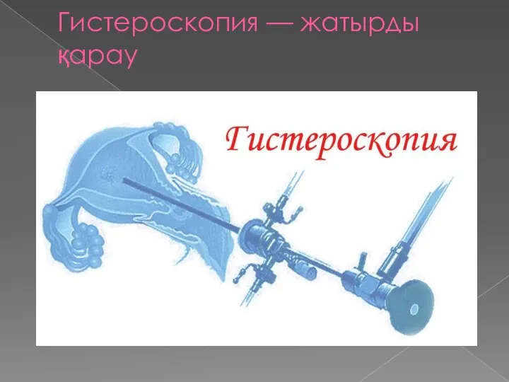 Гистероскопия — жатырды қарау