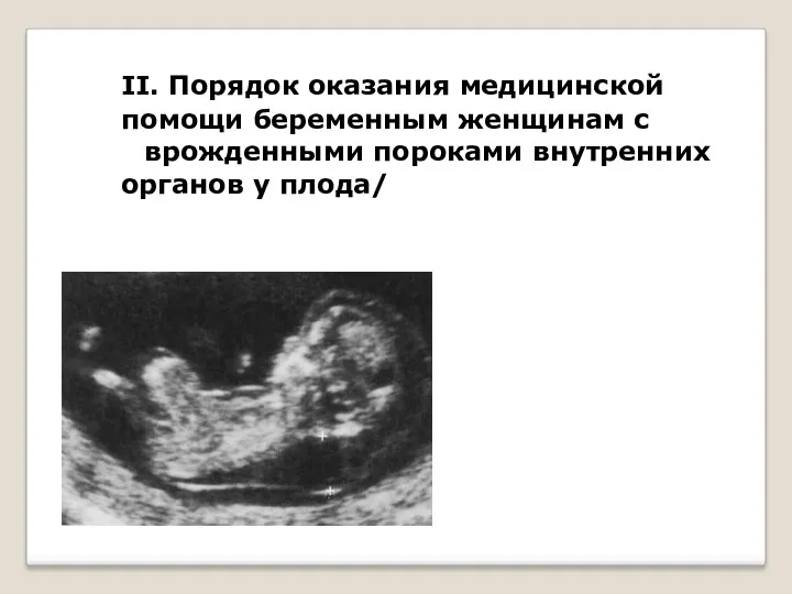 II. Порядок оказания медицинской помощи беременным женщинам с врожденными пороками внутренних органов у плода/