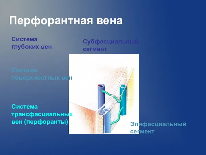 Перфорантная вена Эпифасциальный сегмент Субфасциальный сегмент Система глубоких вен Система поверхностных вен Система трансфасциальных вен (перфоранты)