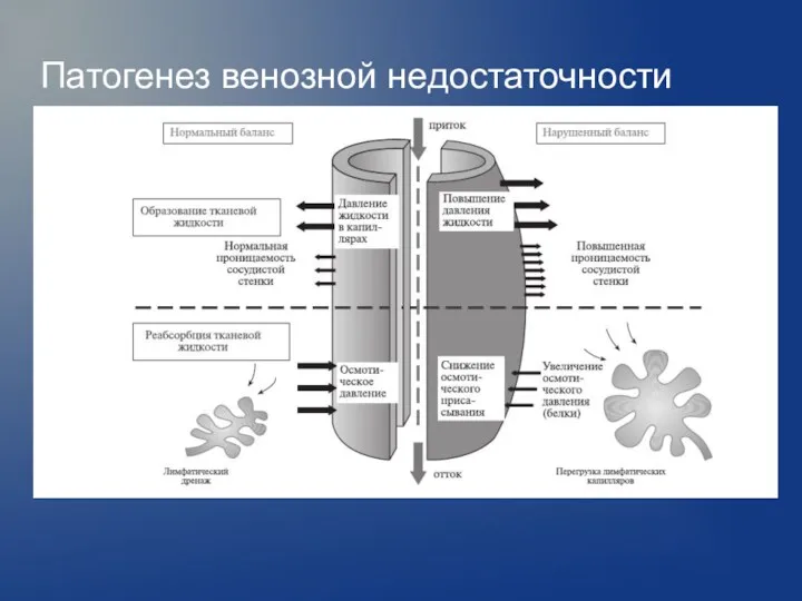 Патогенез венозной недостаточности