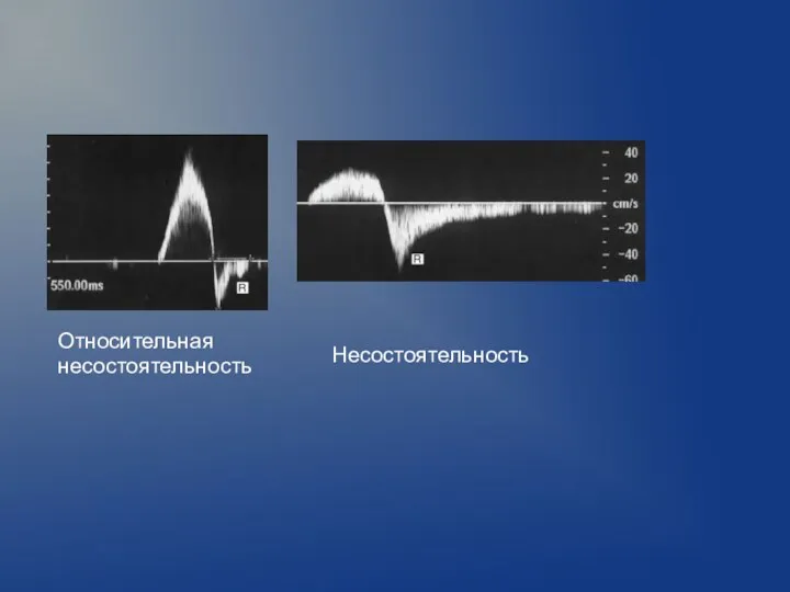 Относительная несостоятельность Несостоятельность