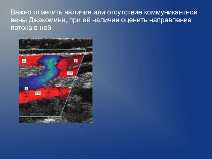 Важно отметить наличие или отсутствие коммуникантной вены Джакомини, при её наличии оценить направление потока в ней