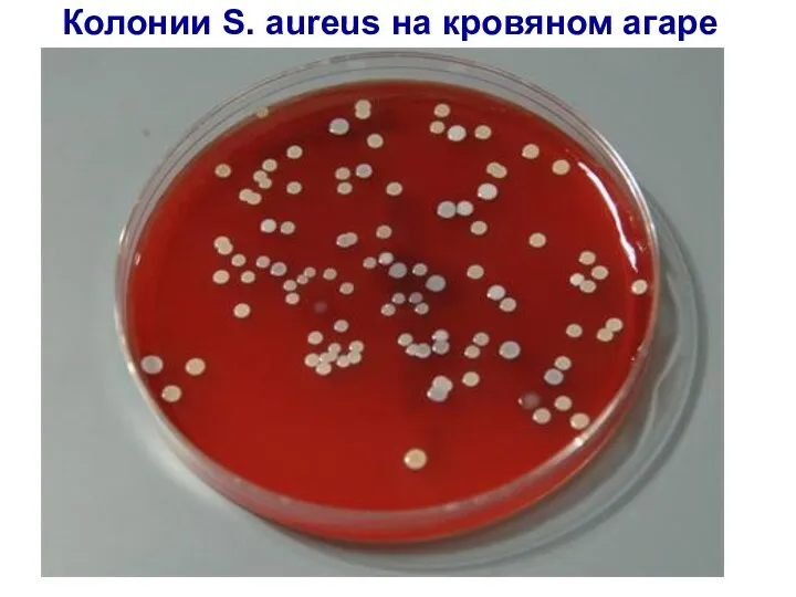 Колонии S. aureus на кровяном агаре