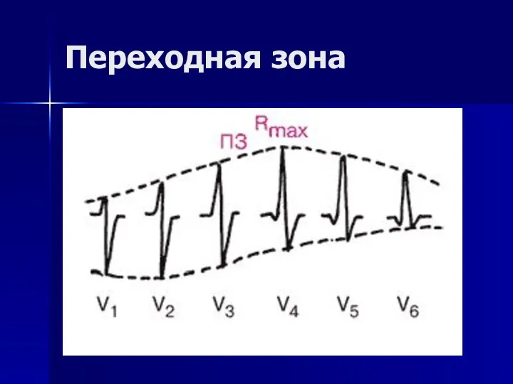 Переходная зона