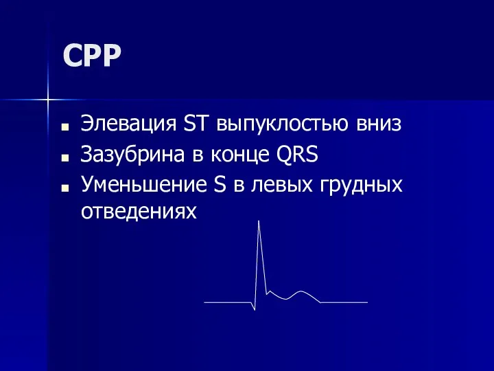 СРР Элевация ST выпуклостью вниз Зазубрина в конце QRS Уменьшение S в левых грудных отведениях