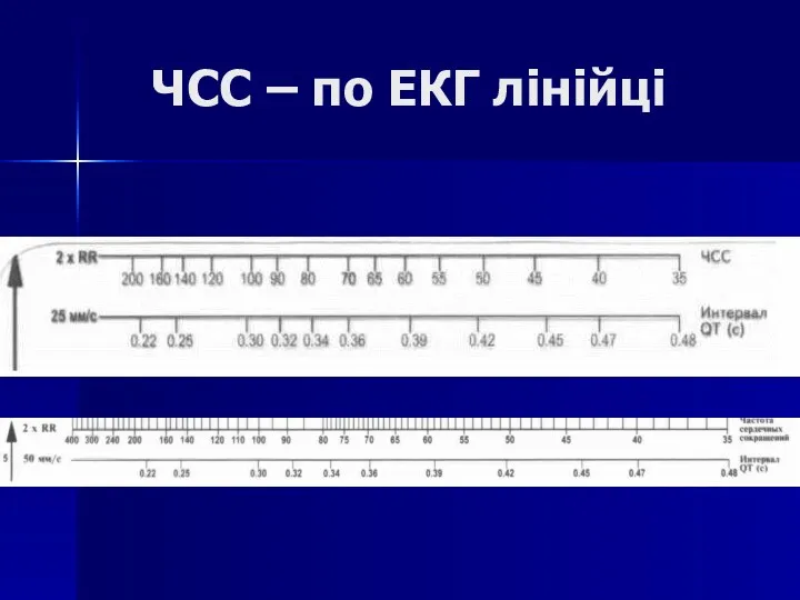 ЧСС – по ЕКГ лінійці