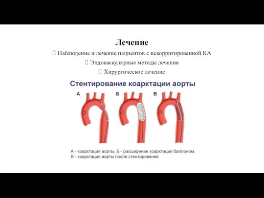 Лечение Наблюдение и лечение пациентов с некорригированной КА Эндоваскулярные методы лечения Хирургическое лечение