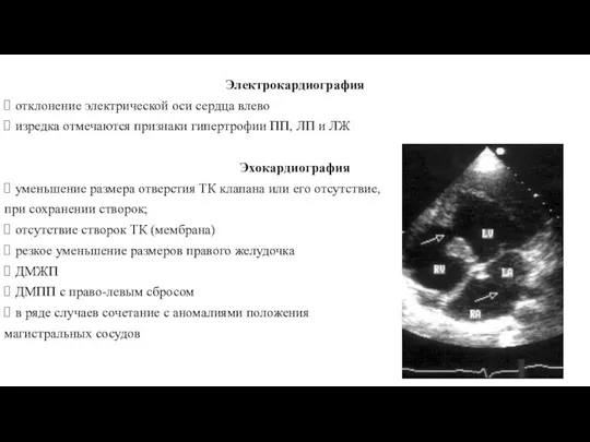 Электрокардиография отклонение электрической оси сердца влево изредка отмечаются признаки гипертрофии